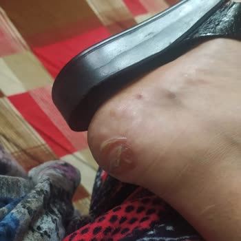 Hakiki Deri Botlar Sağlık Sorunlarına Yol Açtı