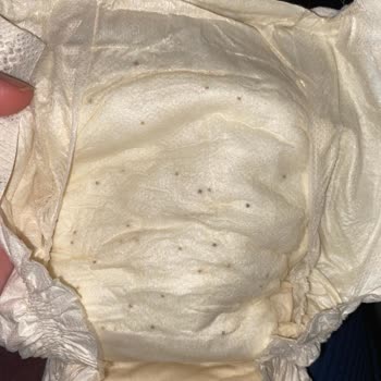 Sleepy Bebek Bezinde Siyah Noktalar