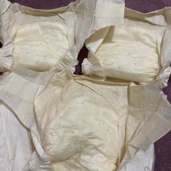 Sleepy Bebek Bezinde Siyah Noktalar