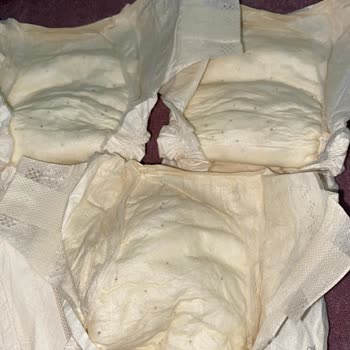 Sleepy Bebek Bezinde Siyah Noktalar