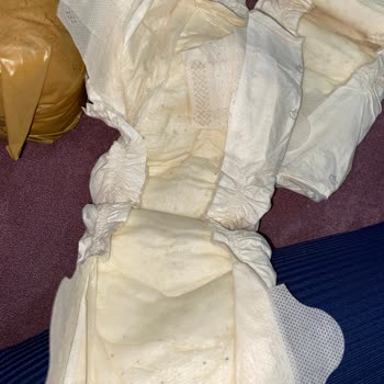 Sleepy Bebek Bezinde Siyah Noktalar