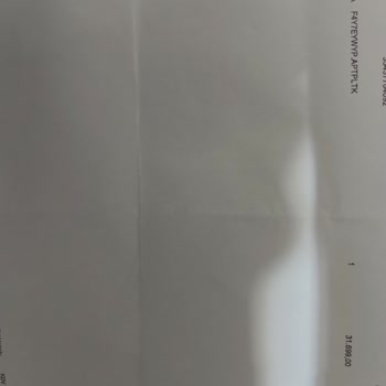 LG Çamaşır Makinesi Gürültü Sorunu Ve Yetersiz Servis