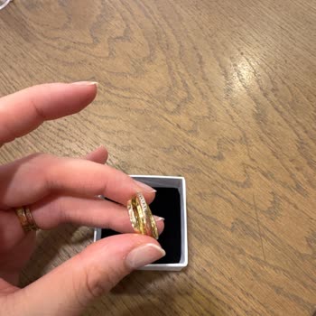 Pandora Yüzüğümde Renk Değişimi Ve Müşteri Hizmetleri Sorunu