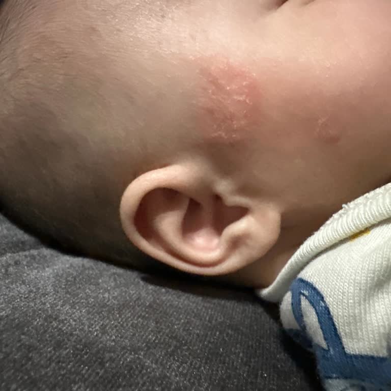 Mustela Bebek Şampuanı Cilt Tahrişine Neden Oldu