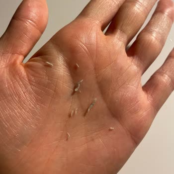 Bozuk Ürün: Kafein Gözaltı Serumu Sorunu