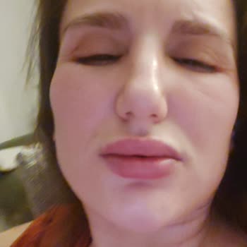 Cilt Bakım Ürünleri Kabusu: Alerjik Reaksiyon