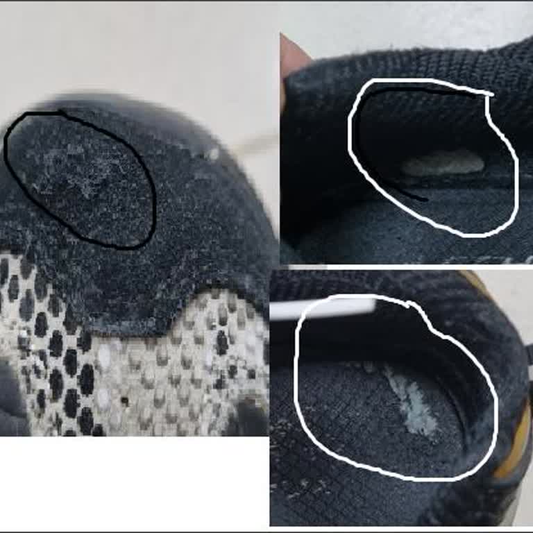 Skechers Ayakkabı Kalitesizliği Ve Mağaza İlgisizliği