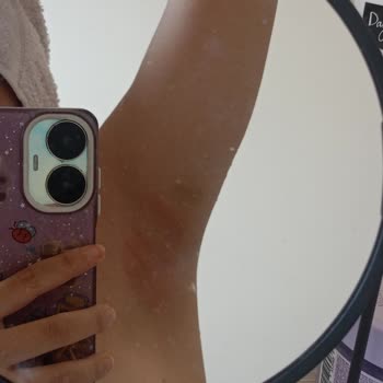 Agiss Tüy Dökücü Sprey Yanıkları Ve Etkisizliği