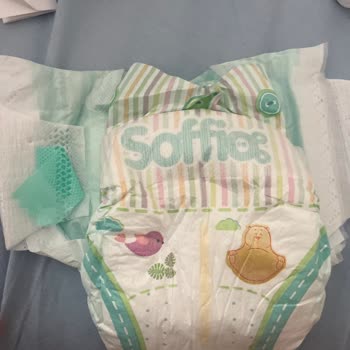 Hatalı Bebek Bezi Ürünü Ve Güven Sorunu