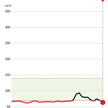 Abbott Freestyle Libre Link'in Ölçüm Hatası: Yanıltıcı Sonuçlar Ve Hayal Kırıklığı