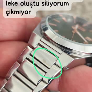 Yeni Model Slazenger Saatin Kordonunda Oluşan Lekeler
