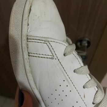 Adidas Ayakkabılarda Yırtılma Ve Şekil Bozukluğu Sorunu