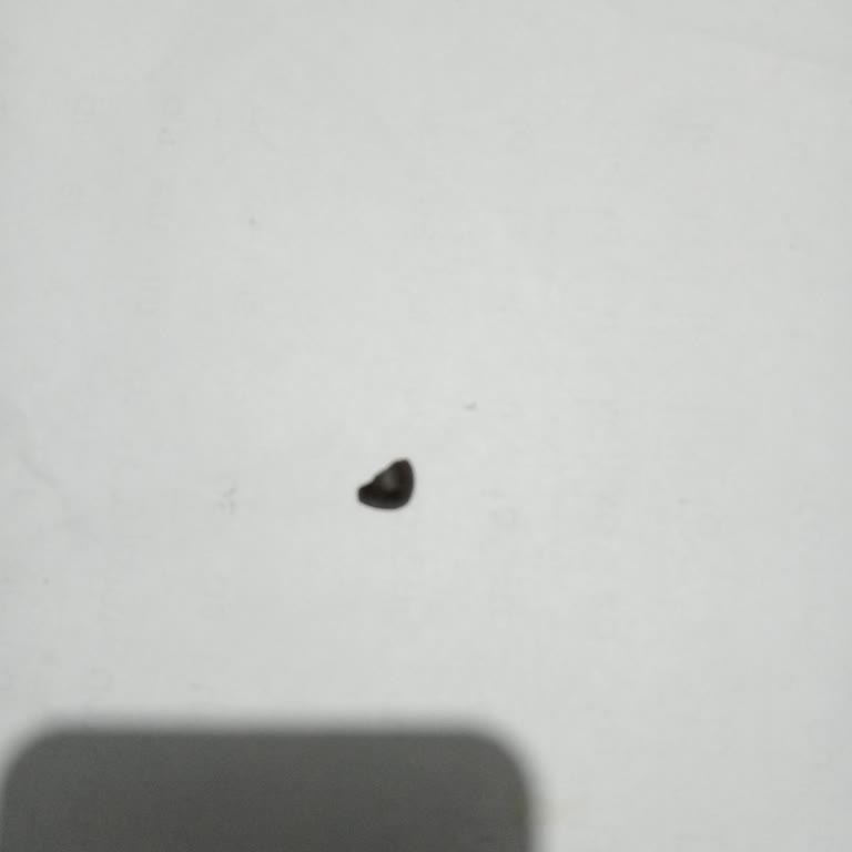 Doğum Günü Pastasından Taş Çıktı