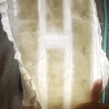 Sleepy Bebek Bezlerinde Kalite Fiyaskosu