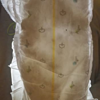 Sleepy Bebek Bezlerinde Kalite Fiyaskosu