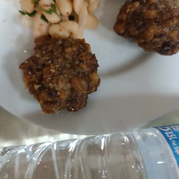 KYK Yurdunda Hijyen Sorunu: Yemekte Kıl Ve Plastik Kelepçe