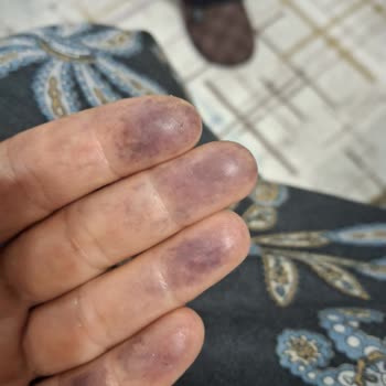 Hertat Çikolatalı Pasta Siparişinde Yanlış Anlaşılma