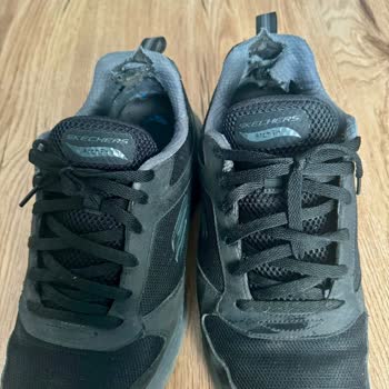 Skechers Ayakkabı Kalitesizliği Ve Garanti Sorunu