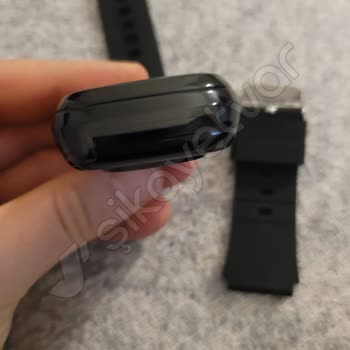 X-Level Akıllı Saatte Kordon Şoku Ve Müşteri Hizmetleri Hayal Kırıklığı