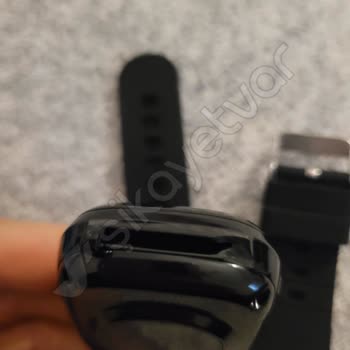 X-Level Akıllı Saatte Kordon Şoku Ve Müşteri Hizmetleri Hayal Kırıklığı