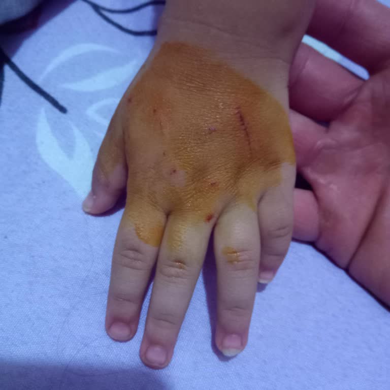 Mağazada Sokak Kedisi Saldırısı: Güvenlik İhmali