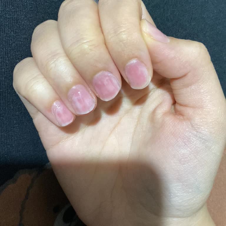 Kalıcı Oje Uygulaması Sonrası Tırnaklarım Mahvoldu