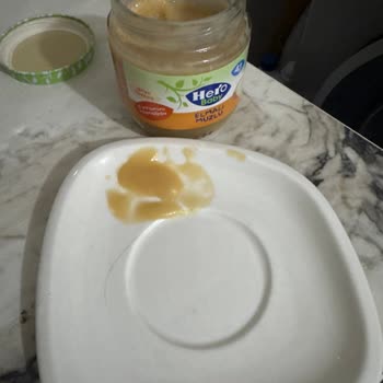 Bebek Mamasında Hijyen Sorunu