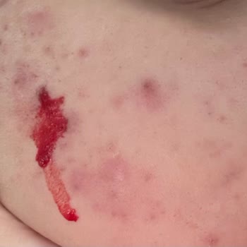 Yanlış Ürün Önerisi Cildimi Mahvetti