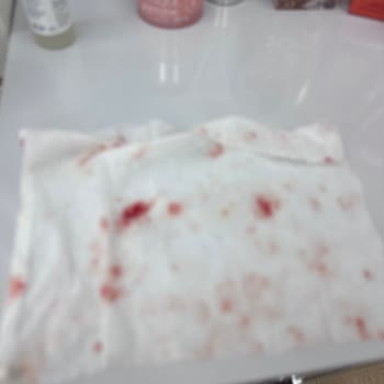 Yanlış Ürün Önerisi Cildimi Mahvetti