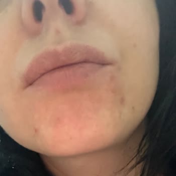 BB Krem Ton Farkı Ve Alerjik Reaksiyon Sorunu