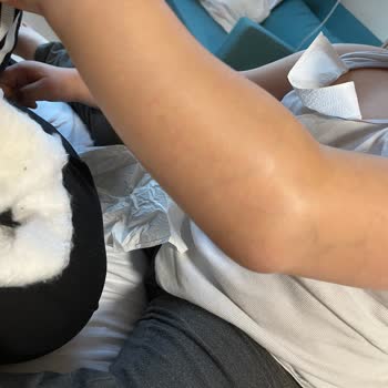 Hastanede Yetersiz İlgi Ve Yanlış Müdahale