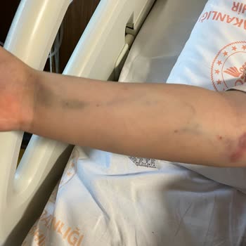 Hastanede Yetersiz İlgi Ve Yanlış Müdahale