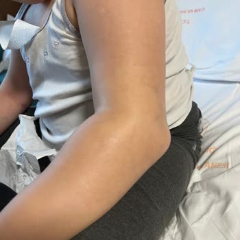 Hastanede Yetersiz İlgi Ve Yanlış Müdahale