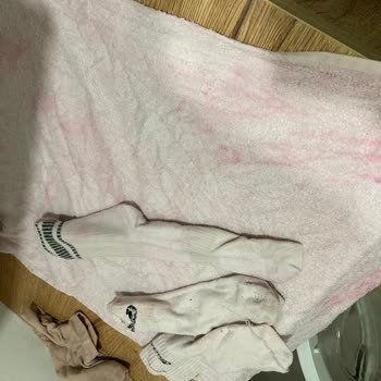 Machinist.com'dan Aldığım Ürün Renk Verdi Ve Müşteri Hizmetleri Hayal Kırıklığı Yarattı