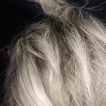 Saç Bakımı Faciası: Hayal Kırıklığı Ve Dökülen Saçlar