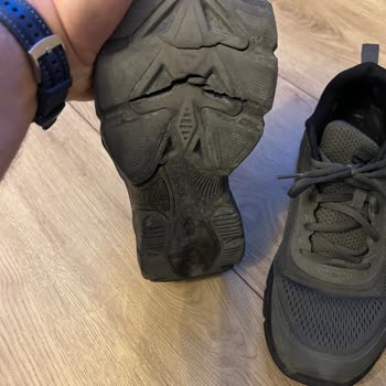 Skechers Ayakkabılarımın Tabanı Parçalandı: Değişim Reddedildi!