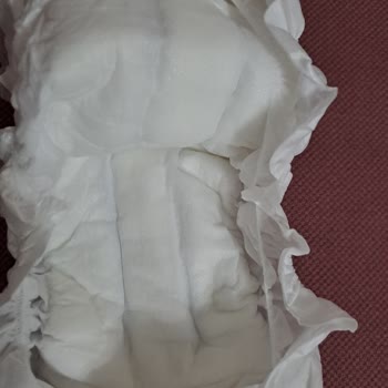 Sleepy Bebek Bezleri: Hayal Kırıklığı Ve Pişik Sorunu