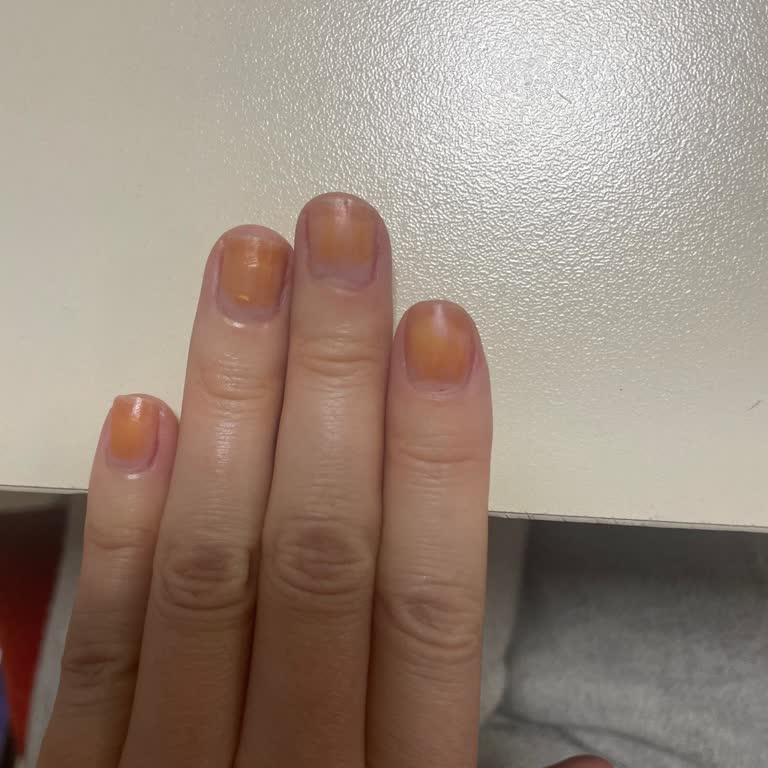 Flormar Ojesi Tırnaklarda Kalıcı Leke Bırakıyor