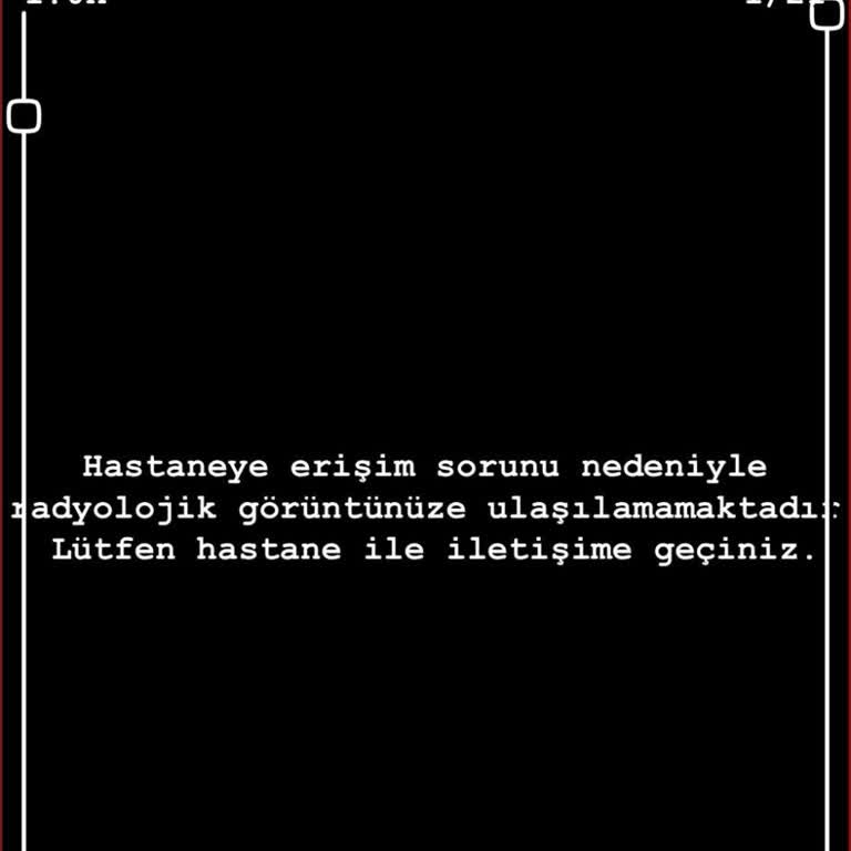 Mardin Midyat Devlet Hastanesi'nde MR Sonuçlarına Erişim Sorunu