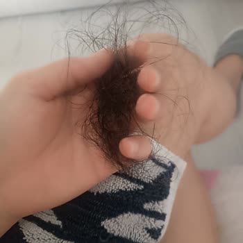 DP Şampuanı Saç Dökülmesine Yol Açıyor