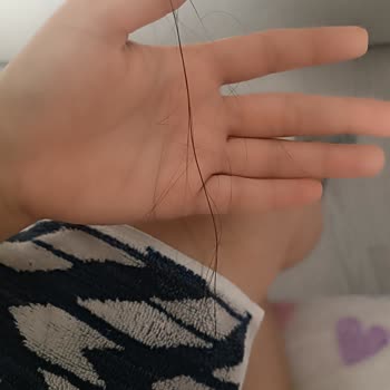 DP Şampuanı Saç Dökülmesine Yol Açıyor