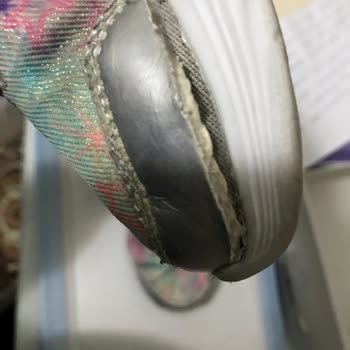 Skechers Ayakkabılar Kızımın Sağlığını Tehdit Ediyor