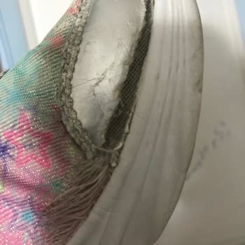 Skechers Ayakkabılar Kızımın Sağlığını Tehdit Ediyor