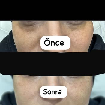 Eki aç