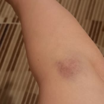 Hastane Kan Alma Biriminde Yaşanan Acı Verici Deneyim