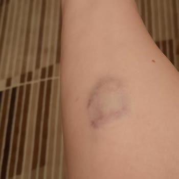 Hastane Kan Alma Biriminde Yaşanan Acı Verici Deneyim