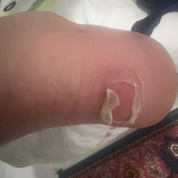 3900₺'lik Ayakkabı İlk Kullanımda Ayaklarıma Zarar Verdi