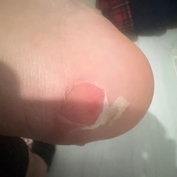 3900₺'lik Ayakkabı İlk Kullanımda Ayaklarıma Zarar Verdi