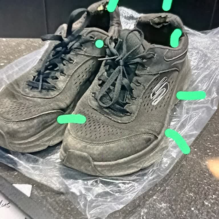 Skechers Ayakkabının Topuk Kısmı Neden Yırtıldı?