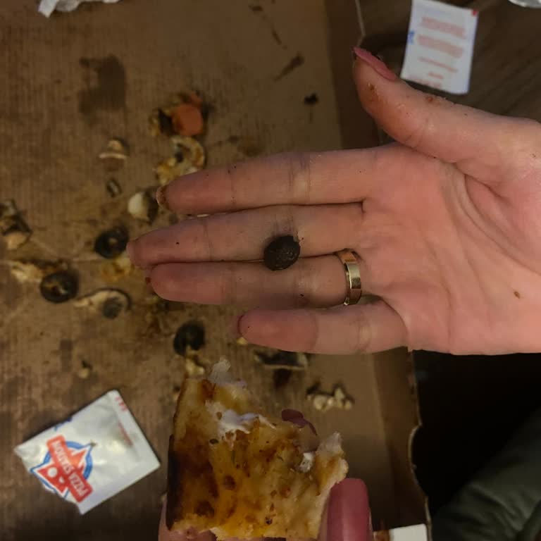 Zeytin Çekirdeği Yüzünden Kırılan Diş Dolgusu